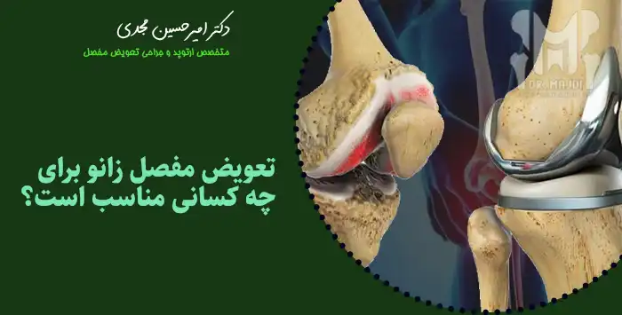 تعویض مفصل زانو برای چه کسانی مناسب است؟