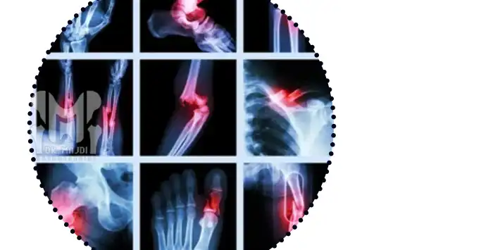 جراحی شکستگی در چه نواحی قابل انجام است؟