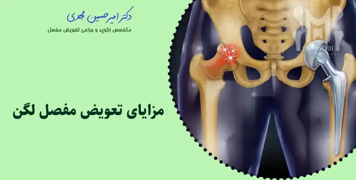 مزایای تعویض مفصل لگن