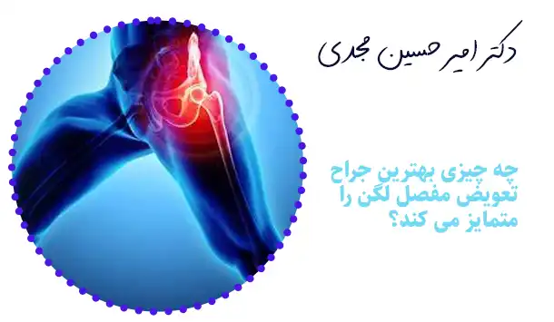 چه چیزی بهترین جراح تعویض مفصل لگن را متمایز می کند؟