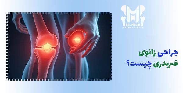 جراحی زانوی ضربدری چیست؟