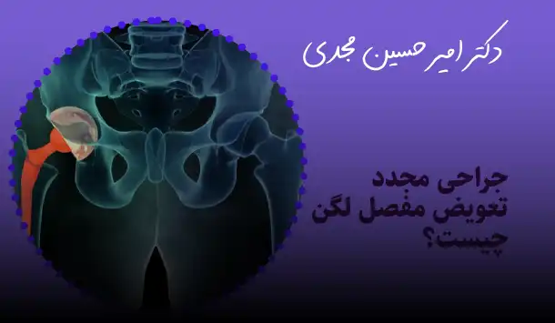 جراحی مجدد تعویض مفصل لگن چیست؟