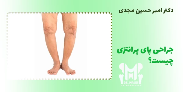 جراحی پای پرانتزی چیست؟