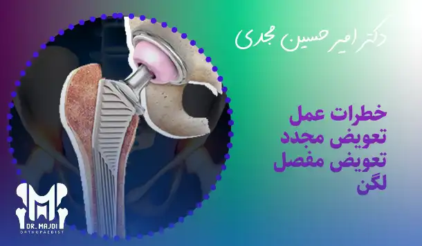 خطرات جراحی تعویض مجدد مفصل لگن