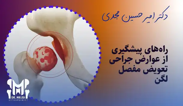 راه‌های پیشگیری از عوارض جراحی تعویض مفصل لگن