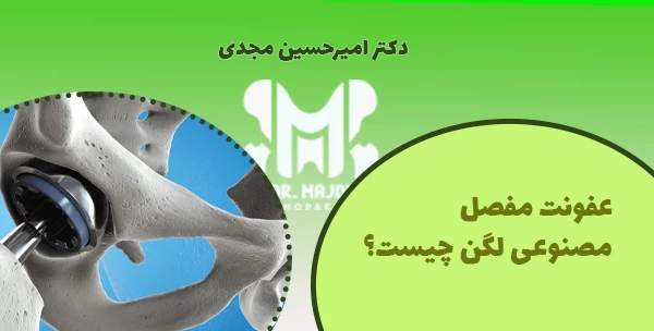 عفونت مفصل مصنوعی لگن چیست؟