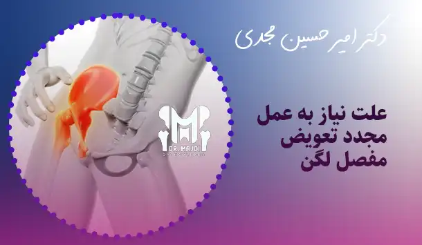 علت نیاز به عمل مجدد تعویض مفصل لگن