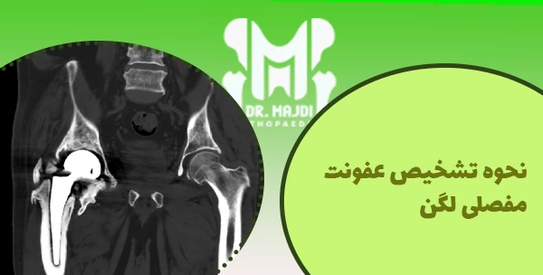 نحوه تشخیص عفونت مفصلی لگن