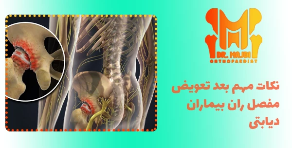 نکات مهم بعد تعویض مفصل ران بیماران دیابتی