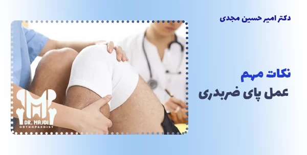نکات مهم عمل پای ضربدری