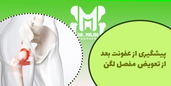 پیشگیری از عفونت بعد از تعویض مفصل لگن