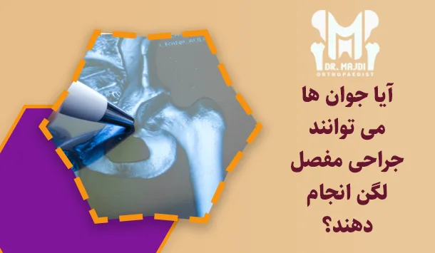 آیا جوان ها می توانند جراحی مفصل لگن انجام دهند؟