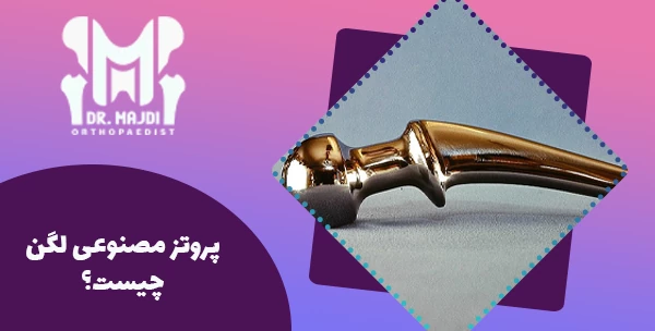 پروتز مصنوعی لگن چیست؟