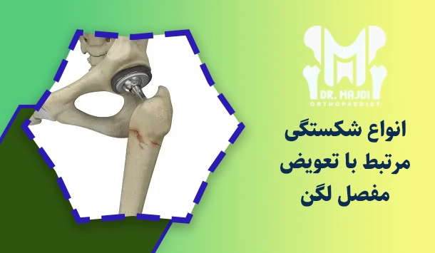انواع شکستگی مرتبط با تعویض مفصل لگن