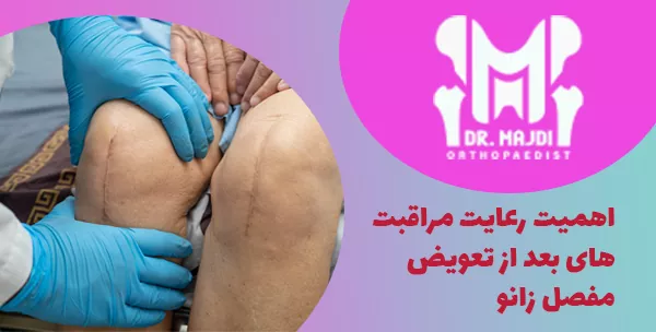اهمیت رعایت مراقبت های بعد از تعویض مفصل زانو