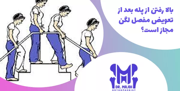 بالا رفتن از پله بعد از تعویض مفصل لگن مجاز است؟