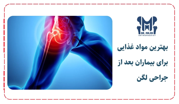 بهترین مواد غذایی برای بیماران بعد از جراحی لگن