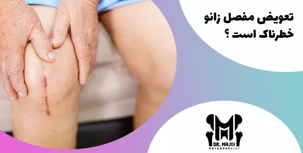 تعویض مفصل زانو خطرناک است ؟ 