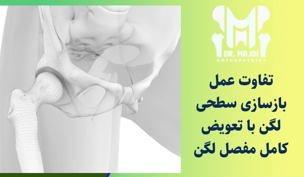 تفاوت عمل بازسازی سطحی لگن با تعویض کامل مفصل لگن