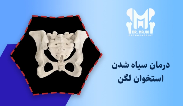 درمان سیاه شدن استخوان لگن
