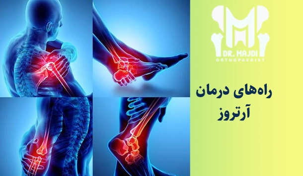 راه‌های درمان آرتروز