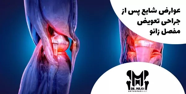 عوارض شایع پس از جراحی تعویض مفصل زانو