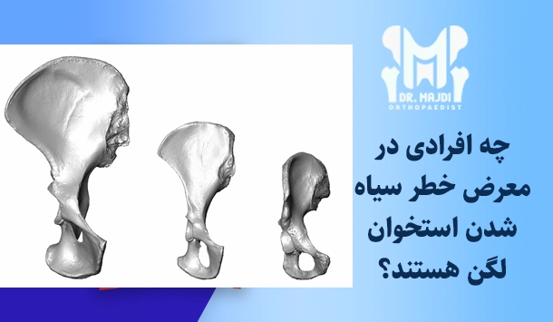 چه افرادی در معرض خطر سیاه شدن استخوان لگن هستند؟