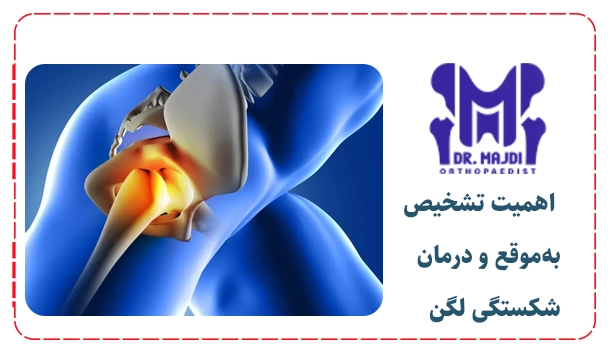  اهمیت تشخیص به‌موقع و درمان شکستگی لگن