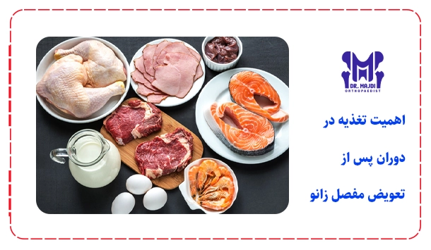 اهمیت تغذیه در دوران پس از تعویض مفصل زانو