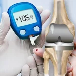 تعویض مفصل زانو در افراد دیابتی