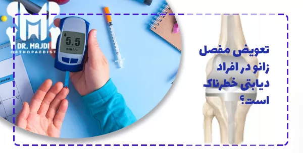 تعویض مفصل زانو در افراد دیابتی خطرناک است؟