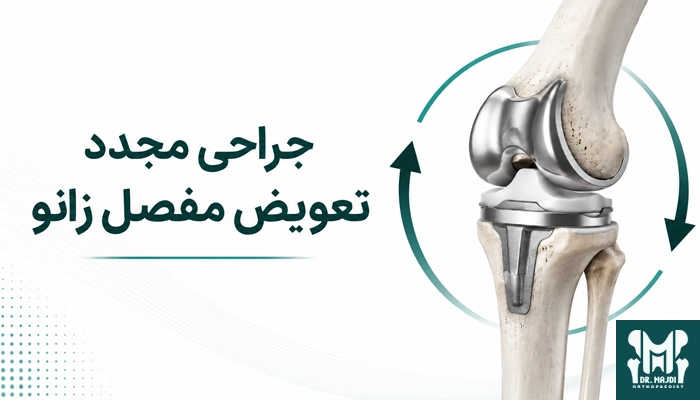 دلایل نیاز به جراحی مجدد تعویض مفصل زانو