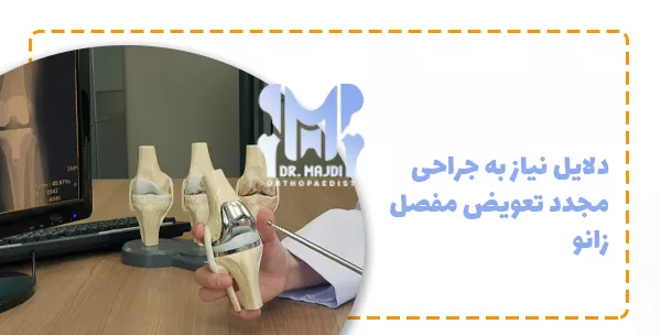 دلایل نیاز به جراحی مجدد تعویض مفصل زانو
