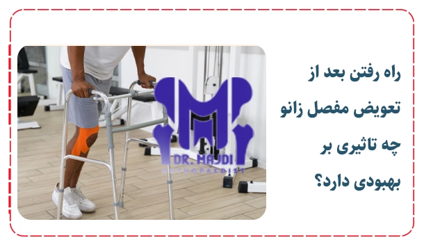 راه رفتن بعد از تعویض مفصل زانو چه تاثیری بر بهبودی دارد؟
