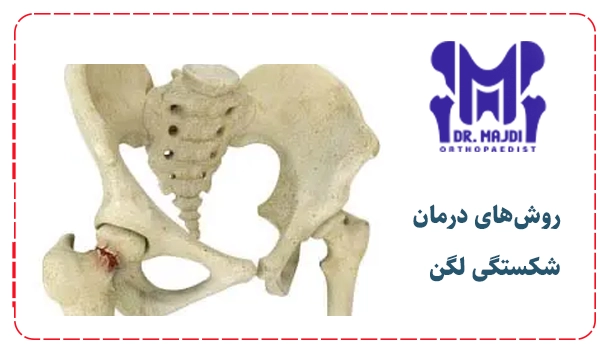 روش‌های درمان شکستگی لگن