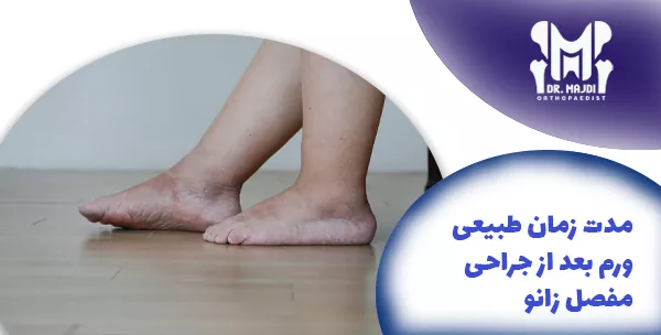 مدت زمان طبیعی ورم بعد از جراحی مفصل زانو