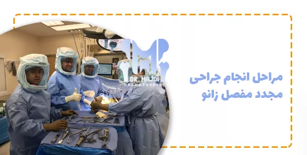 مراحل انجام جراحی مجدد مفصل زانو