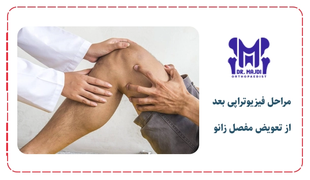 مراحل فیزیوتراپی بعد از تعویض مفصل زانو