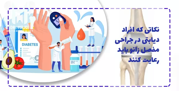 نکاتی که افراد دیابتی در جراحی مفصل زانو باید رعایت کنند