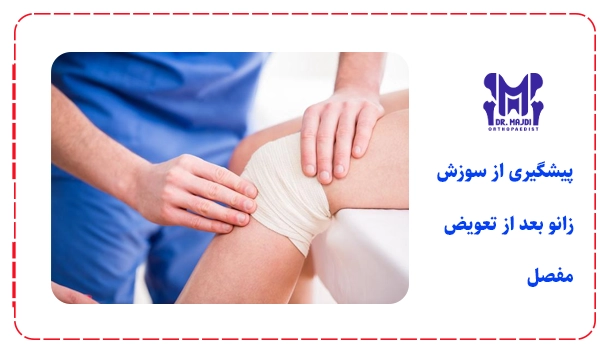 پیشگیری از سوزش زانو بعد از تعویض مفصل