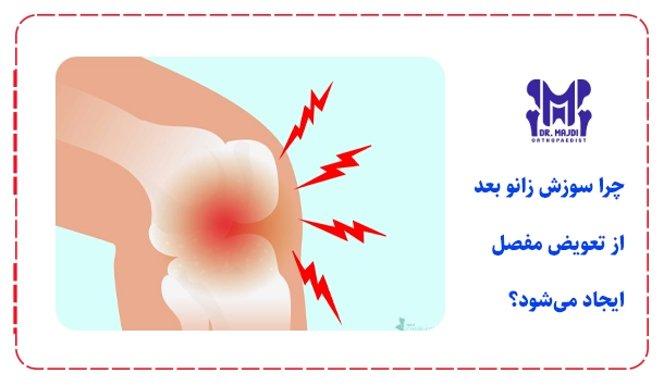 چرا سوزش زانو بعد از تعویض مفصل ایجاد می‌شود؟