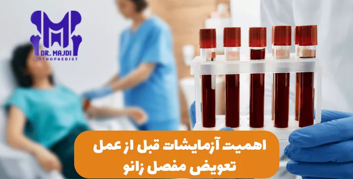 اهمیت آزمایشات قبل از عمل تعویض مفصل زانو 