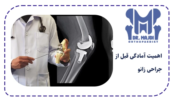 اهمیت آمادگی قبل از جراحی زانو