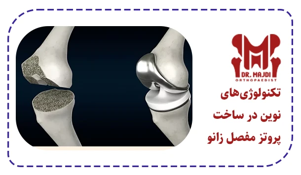 تکنولوژی‌های نوین در ساخت پروتز مفصل زانو