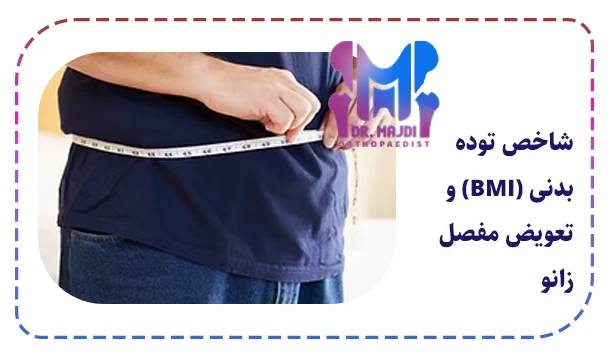 شاخص توده بدنی (BMI) و تعویض مفصل زانو