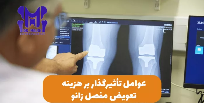 عوامل تأثیرگذار بر هزینه تعویض مفصل زانو