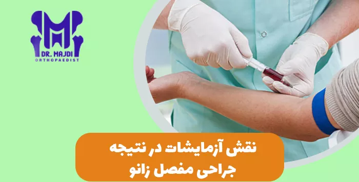نقش آزمایشات در نتیجه جراحی مفصل زانو