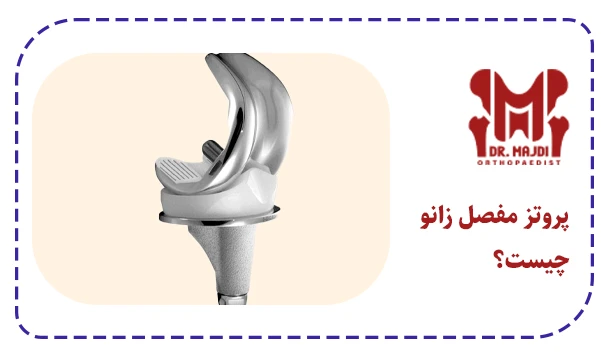 پروتز مفصل زانو چیست؟