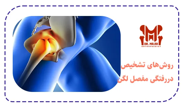 روش‌های تشخیص دررفتگی مفصل لگن