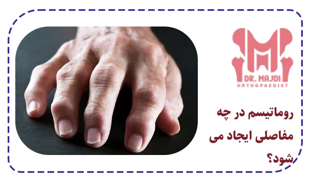 روماتیسم در چه مفاصلی ایجاد می شود؟